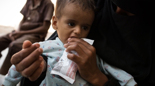 A child receives treatment for malnutrition from his mother